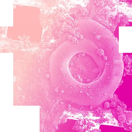 01-Cryo ET Sample Preparation-mobile