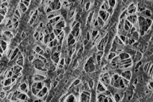 1_SEM investigation of polyethylene battery separator-1