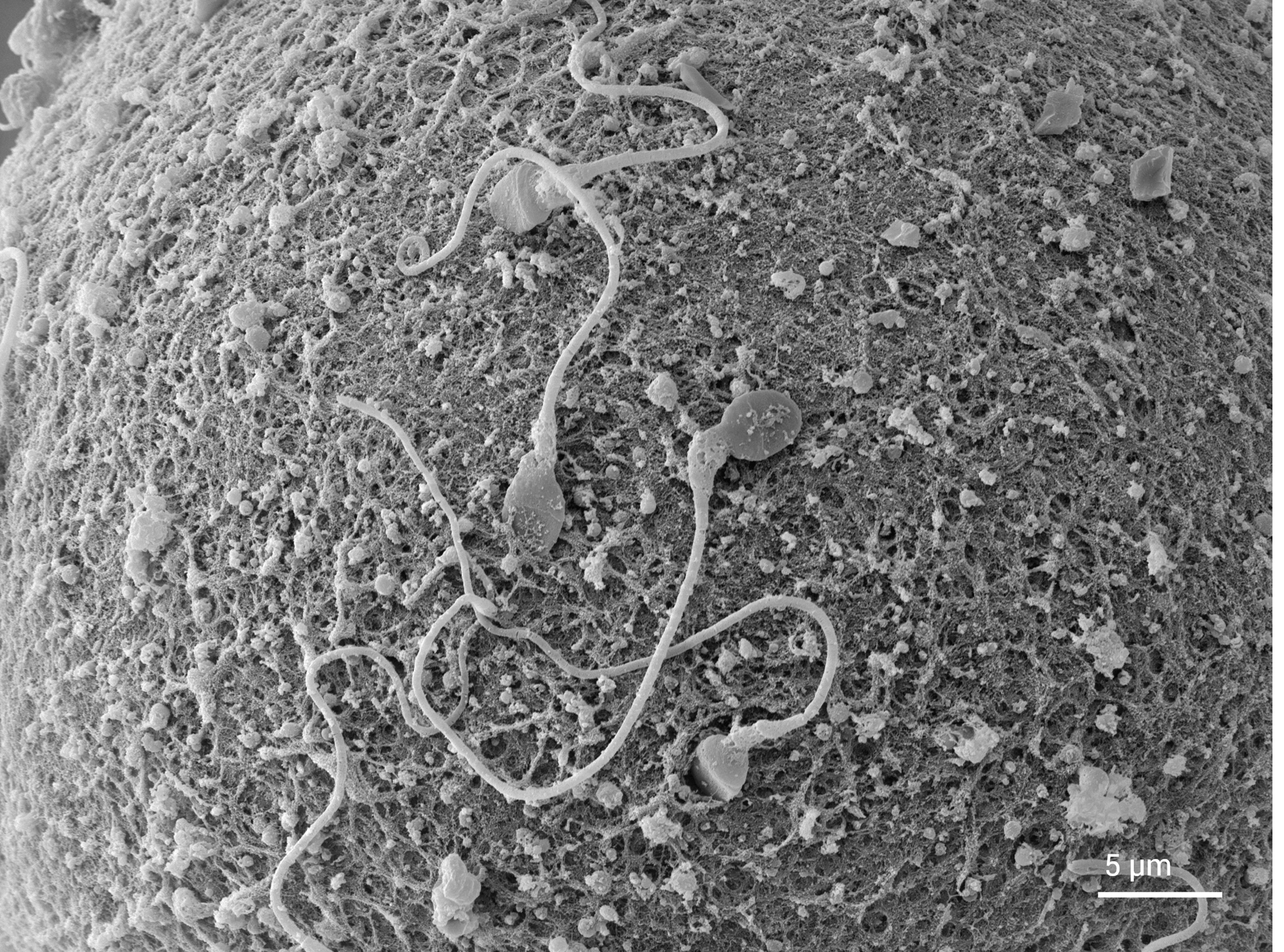 Resolve Fine Surface Architecture and Sperm Head Detail at Higher Magnification