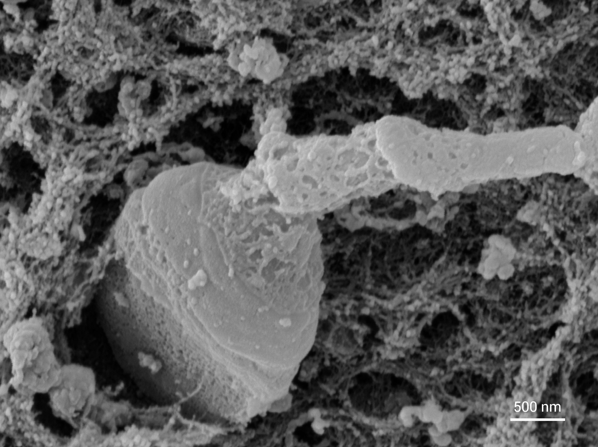 Visualize Sperm Head Morphology and Acrosomal Breakdown in Detail