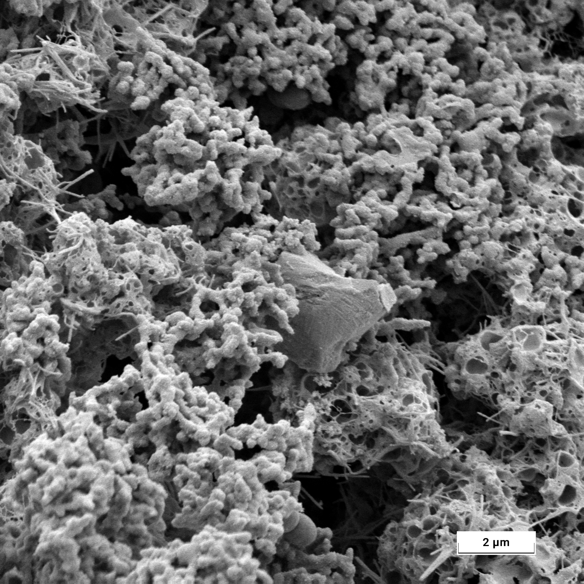 Visualize Casein Micelles and Protein Networks
