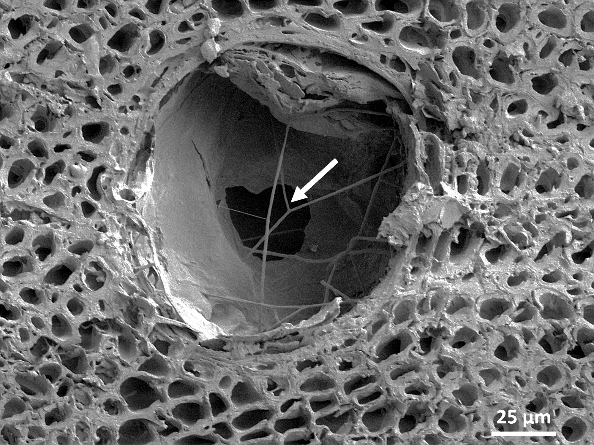 Monitor Infection Spread Across Vascular Networks