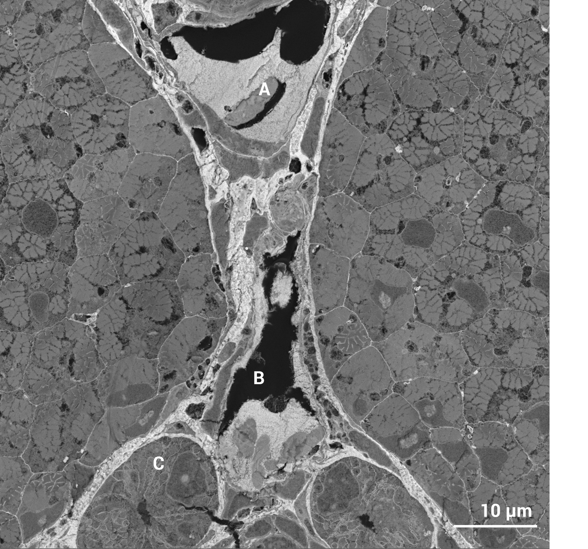 Resolve Fine Tissue Structures Within Zebrafish Embryos