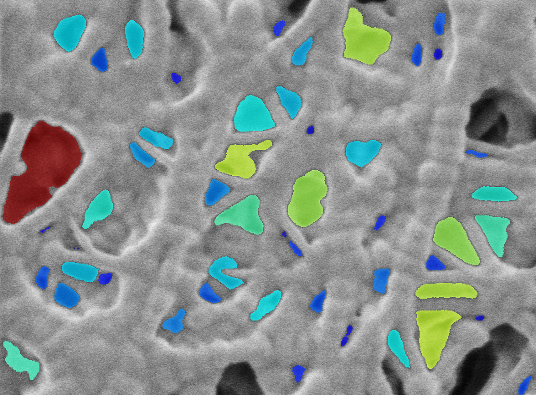 5_Separator pore identification for size distribution analysis
