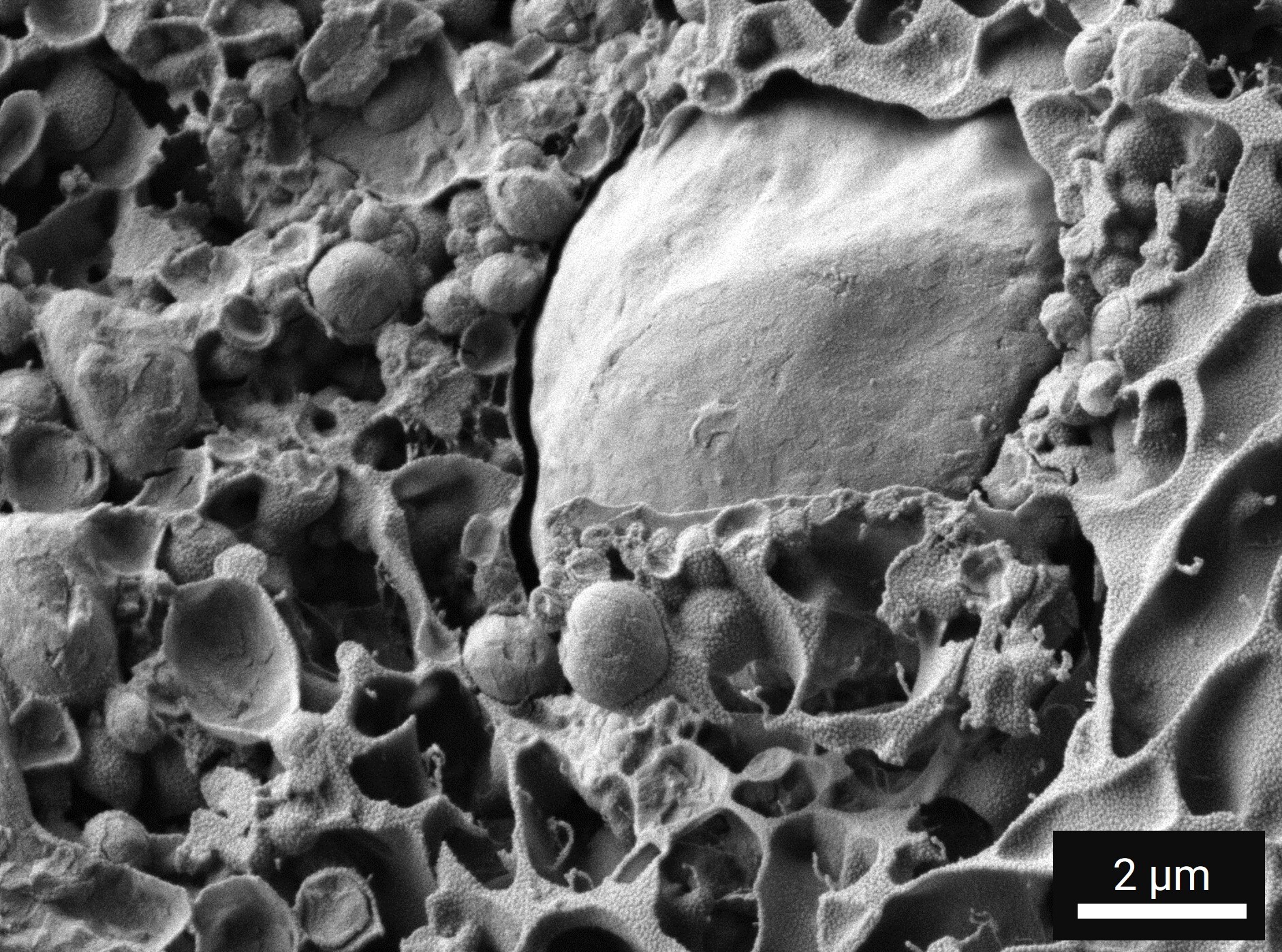Visualizing Interfaces Between Fat Globules and Protein Networks