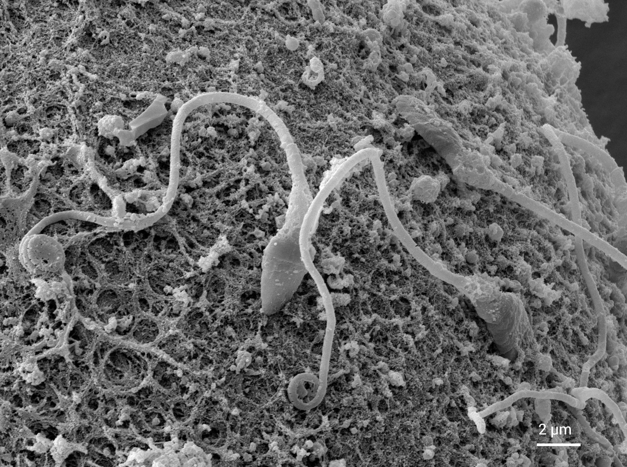 Preserve Surface Detail across the Curved Oocyte with High Depth of Focus